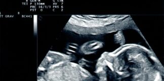 Kluczowe informacje o badaniu ultrasonograficznym podczas ciąży
